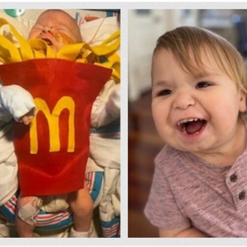 french fry baby